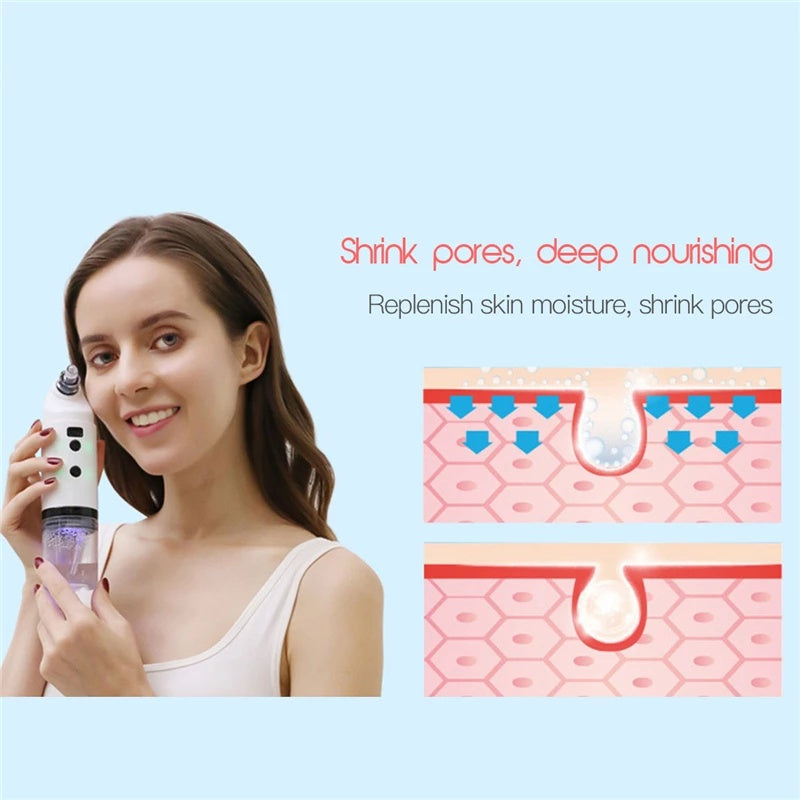 Electric Facial Cleaner
